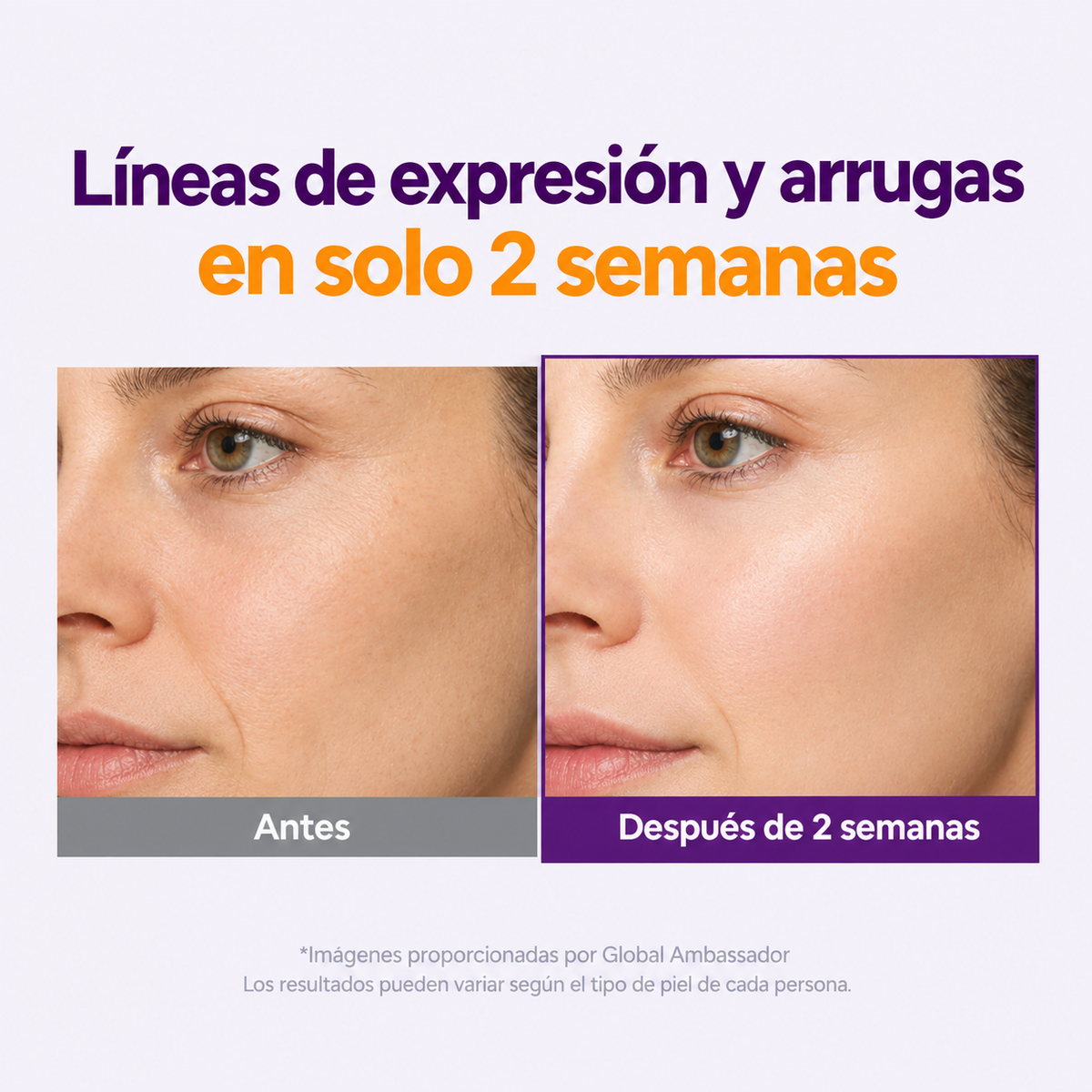 Sérum Retinol Retinal 2000 NAD+ Serum Purito Seoul – Líneas, firmeza y textura