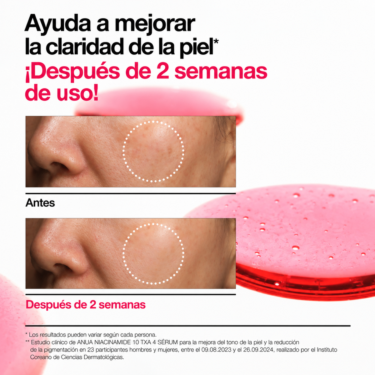Sérum Niacinamide 10% + TXA 4% Anua – Manchas, marcas post acné y tono parejo 30 ml